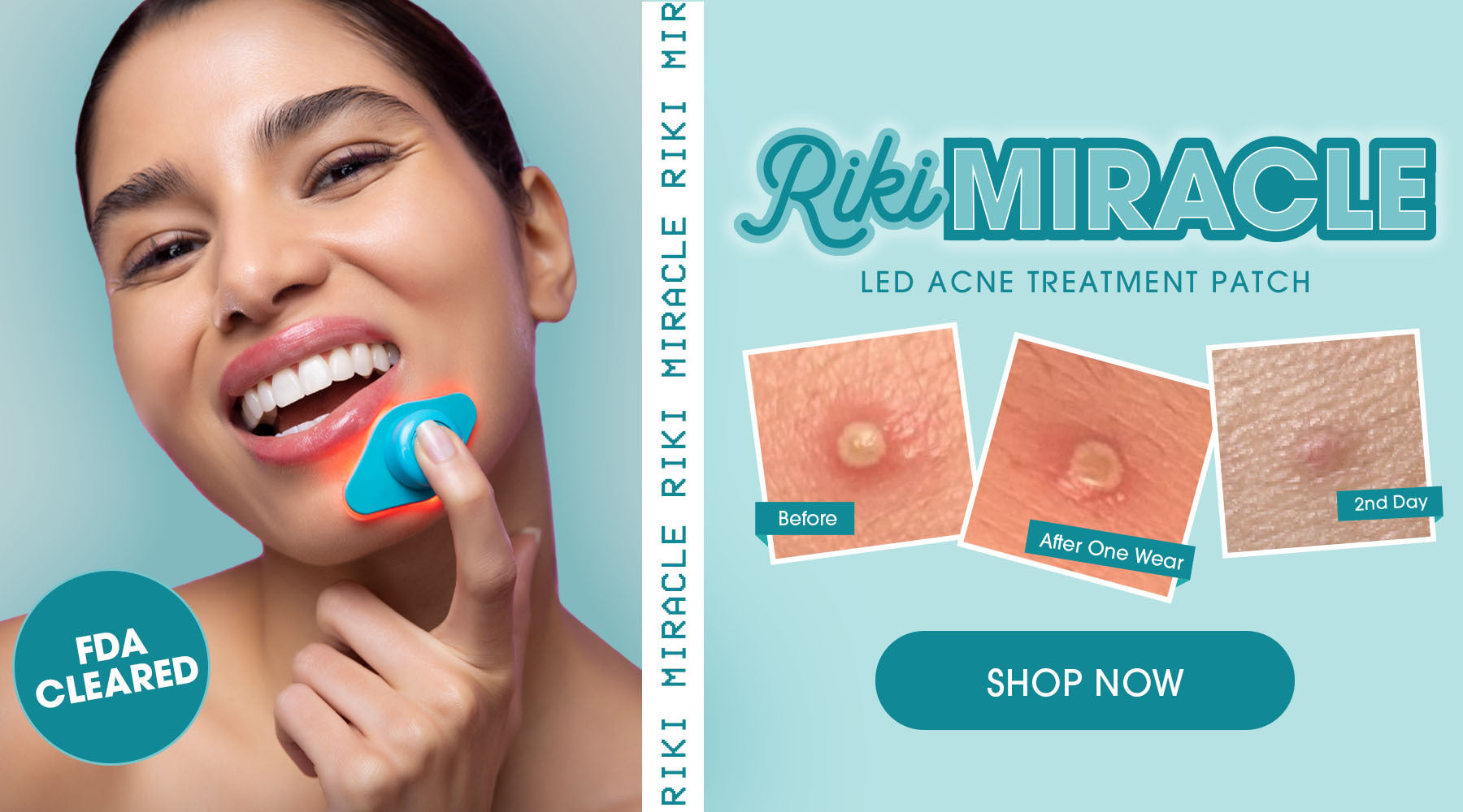 RIKI MIRACLE LED ACNE TREATMENT PATCH