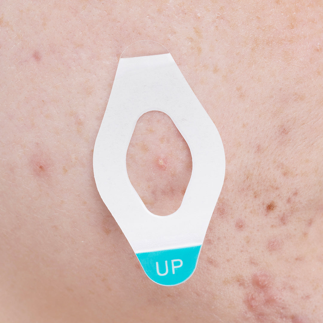 Small size RIKI MIRACLE Tape Refill for precise LED acne patch application.